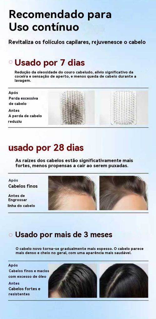 Bodywise Sérum Roll-On Alecrim 🚀 Perda de Cabelo Metade em 7 Dias, Cabelo Denso Insano em 3 Meses, Calvície Adeus para Sempre!