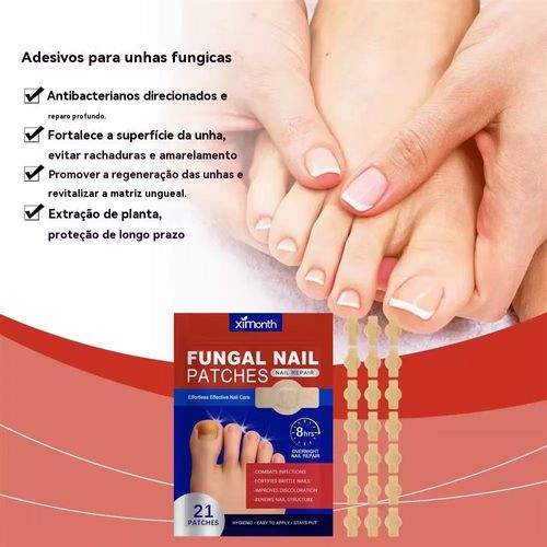 Ximonth Parche de Reparo de Unhas Fungosas🌿 Ingredientes Vegetais Reparo Profundo 8 Horas 21 Parches Uso Dia e Noite