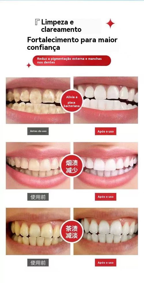 ✨Creme Dental Probiótico YAYASHI SP-4 – Clareia Dentes, Remove Manchas e Fresca Hálito para Angola! 😁