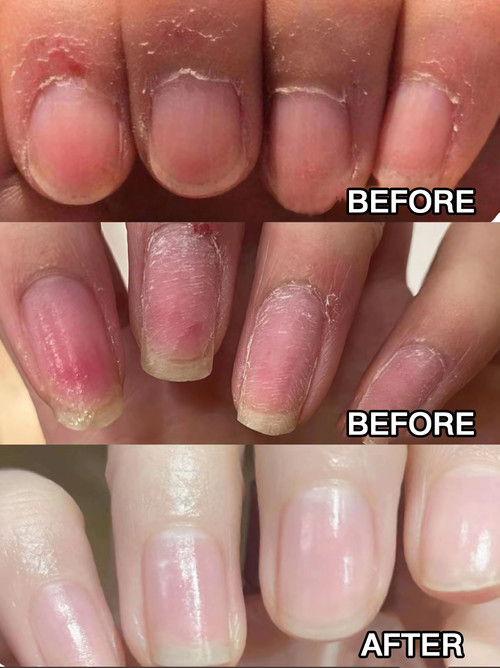 Nail Care Pen
