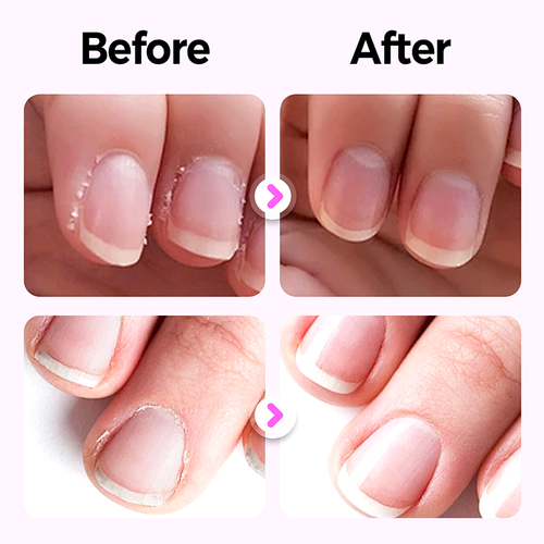 Nail Care Pen