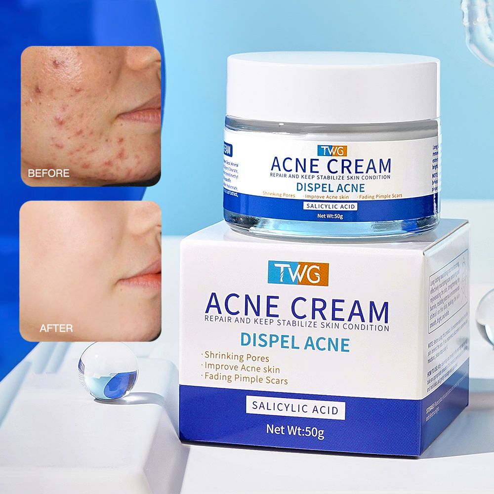 TWG Salicylic Acid Acne Cream