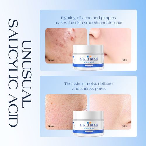 TWG Salicylic Acid Acne Cream