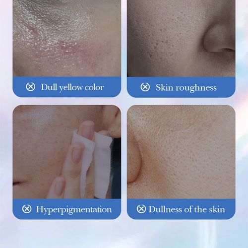 Nicotinamide Whitening and Freckle-Removing Cream 50g