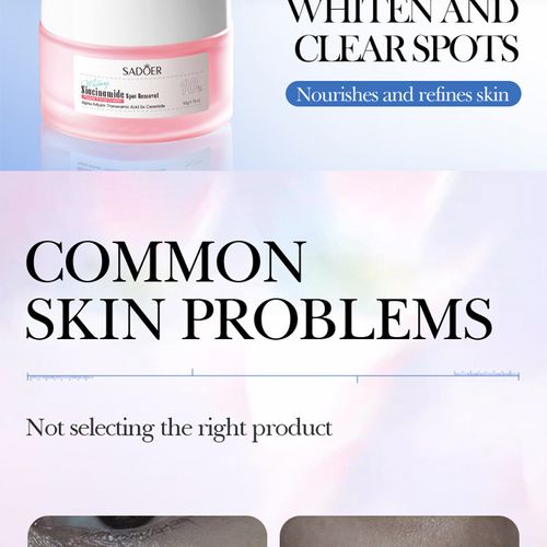 Nicotinamide Whitening and Freckle-Removing Cream 50g