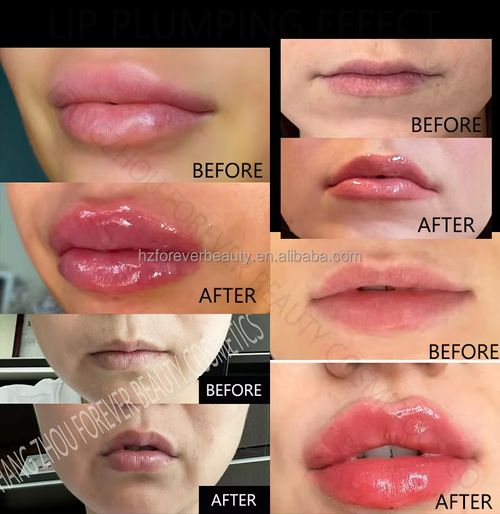 Maximum Volume Lip Plumper – Vegan