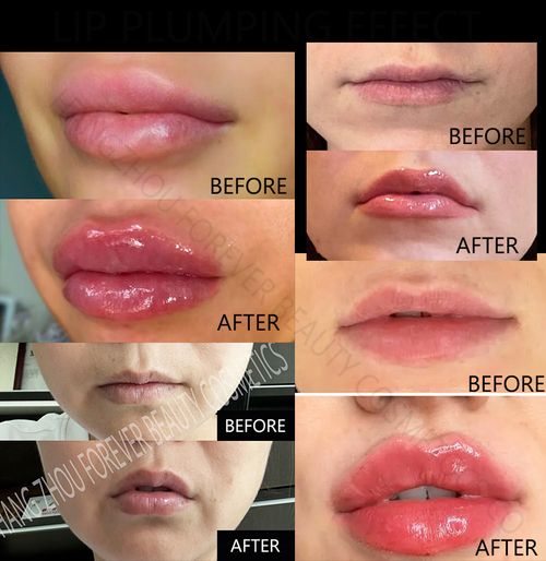 Maximum Volume Lip Plumper – Vegan