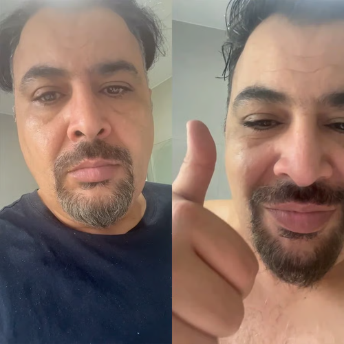 🎉Hot Sale🎁 KovaHair Instant Dye Shampoo