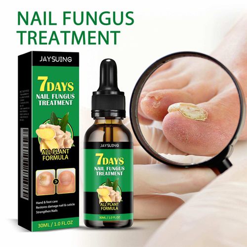 Ginger Nail Care Solution for Gentle Maintenance of Fingernails and Toenails