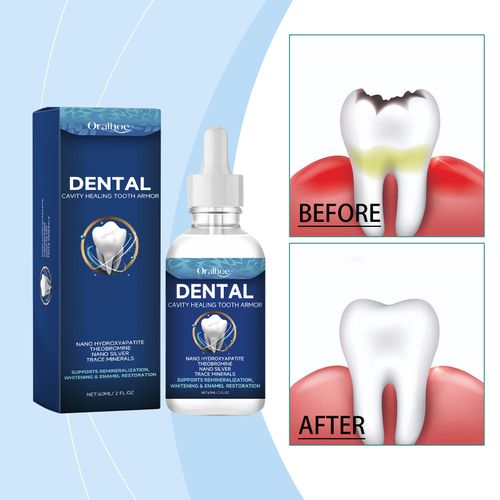 Dental Care Fluid Gentle Gum Care & Oral Cleansing Essence