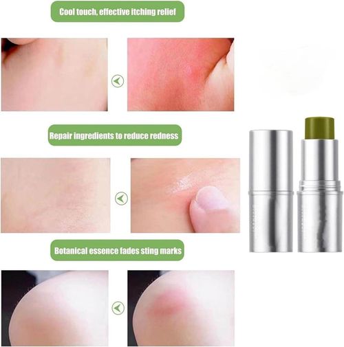 Comfrey Ointment for Mosquito Bites: Reduces Swelling, Relieves Itching, and Repels Insects