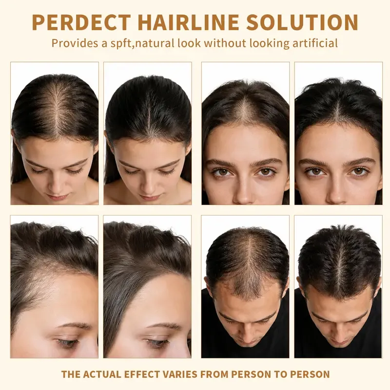 SEVICH Hairline Powder - Root Touch Up Hair Color for Gray Coverage ,48 Hour Stain Proof,Thickening & Concealing for Women & Men,