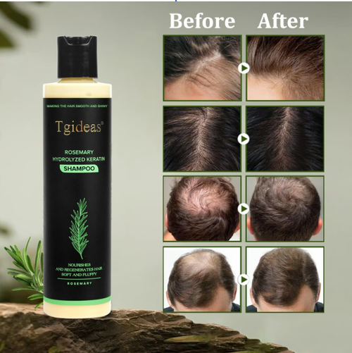 Tgideas Organic Rosemary Hair Shampoo