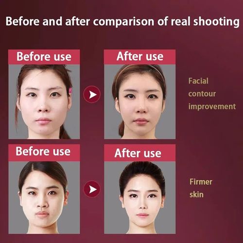 💥💥💥V-shaped facial lifting device with double chin massage function - facial tightening device with vibrating facial lifting beauty appliance