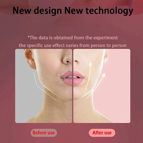 💥💥💥V-shaped facial lifting device with double chin massage function - facial tightening device with vibrating facial lifting beauty appliance