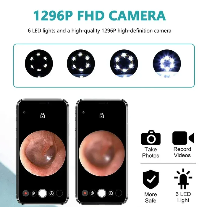 💥💥💥Limited Time Discount✨Smart Ear Cleaner High Precision with Camera LED