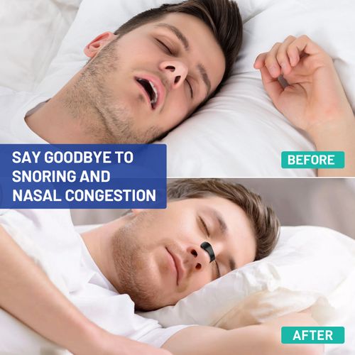 Breathing Magnetic Nasal Strips Starter Kit (30 pairs)