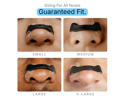 👃Magnetic nasal dilator👍