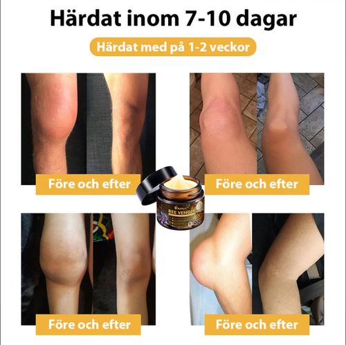 Aetheris™ Bee Venom Arthritis Treatment Cream (👩🏼‍⚕️Especially for Older Adults)
