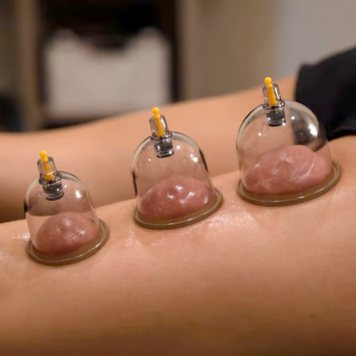 Vacuum Cupping Therapy Set