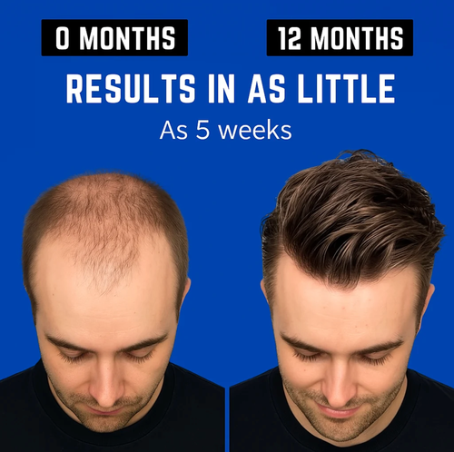 Hair Revival Hat 🚨 Hair Getting Thinner? Time to Take Action.
