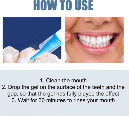 Teeth Whitening Repair Gel