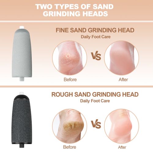 New Rechargeable Electric Foot Grinder with 2 Grinding Heads - Remove Calluses, Dead Skin & Cracked Heels, Portable Pedicure Exfoliator for Home Foot Care