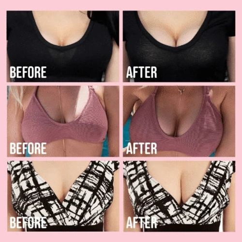 The Original Rabbit Bra invisible Lifting Push-Up Bra⏰（Buy 1 Get 1 Free for a limited time）