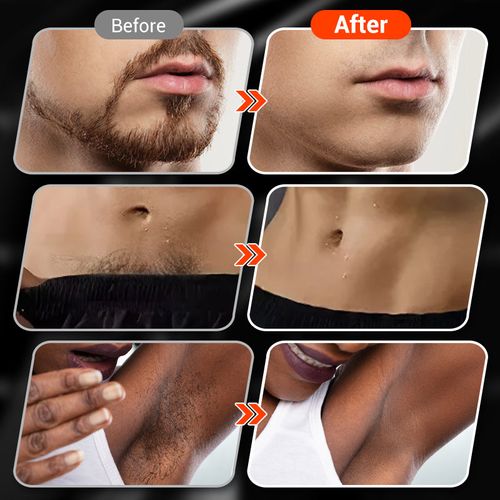 🔥Hot Sale 50% Off🔥Magnetic Rechargeable Electric RazorMagnetic Rechargeable Electric Razor