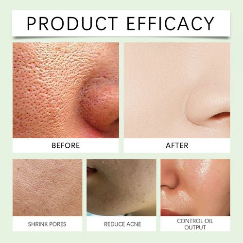 🔥Hot Sale🔥GreTeam Purifying Exfoliating Gel