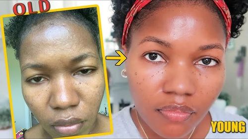Purifying Exfoliating Gel (Buy 1 Get 1 Free)
