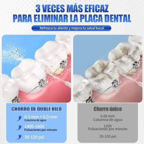 Irrigador Bucal, Irrigador Bucal Inalámbrico Portatil 3 Modos de Limpieza y 4 Puntas IPX7 Impermeable Limpiador de Dientes Recargable por USB para Hogar y Viajes (Negro)