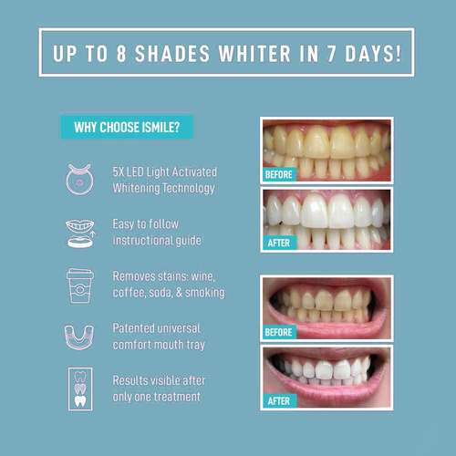 🚨Yellow Teeth? Gone in Days! This LED Whitening Kit is a Game - Changer! 🔥