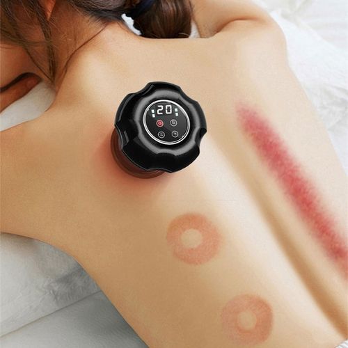 Smart Electric Cupping & Gua Sha Massager