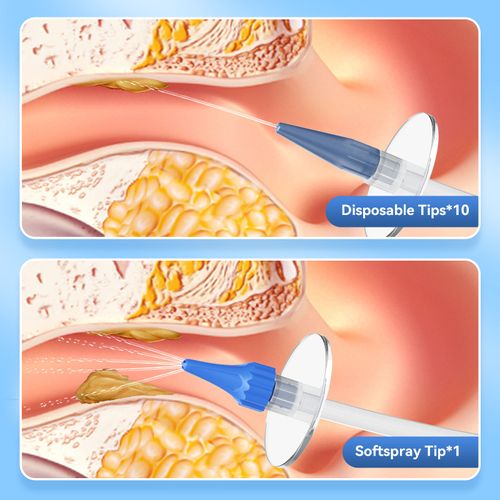 Propulse Ear Irrigator Home Use Ear Care Solution