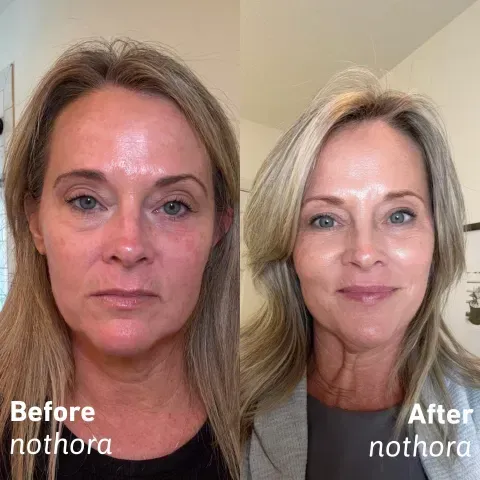 Conopeptide Anti-Wrinkle Stick: Neck Line Smoothing, Moisturizing, and Firming Cream — MSDS