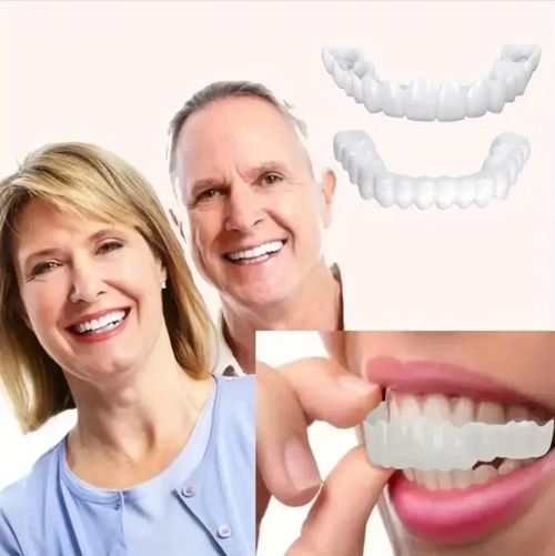 ComfortFlex White Dentures with Veneers
