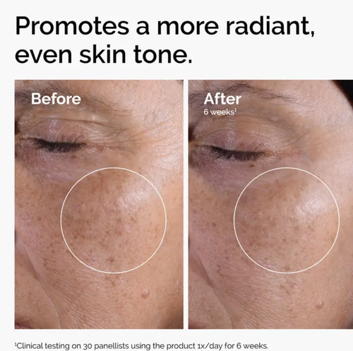 The Ordinary Glycolic Acid 7% Exfoliating Toner