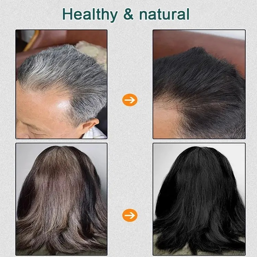 300ml（10 bags）-Natural Plant Hair Dye