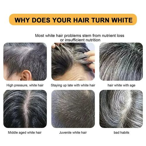 White Hair Darkening Shampoo Soap - Restore Grey Beard & Hair Naturally ( BUY 1 GET 1 FREE )