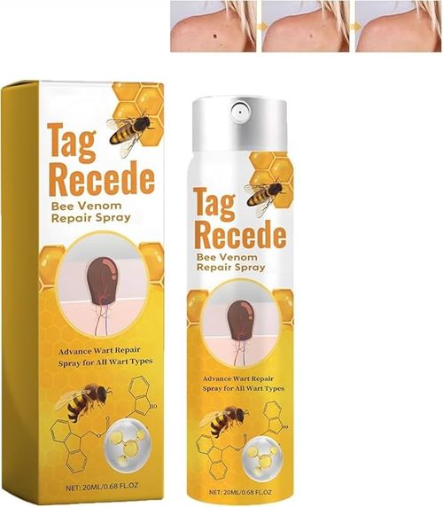 Tag & Wart Remover Spray - Wart and Tags Removal Treatment Spray