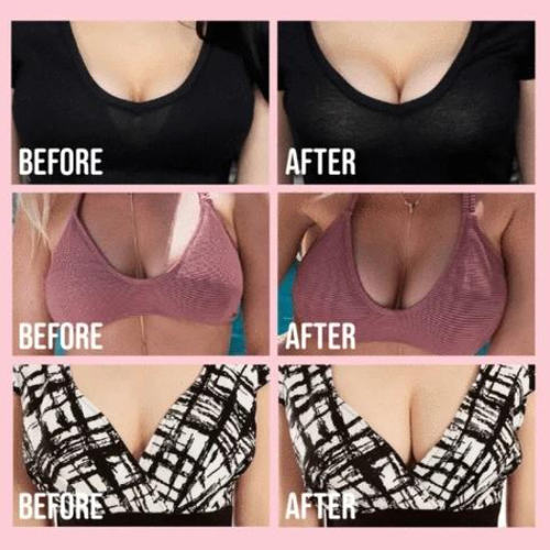Reusable Lift Up Invisible Tape Bra（1 Pair Black + 1 Pair Cream）