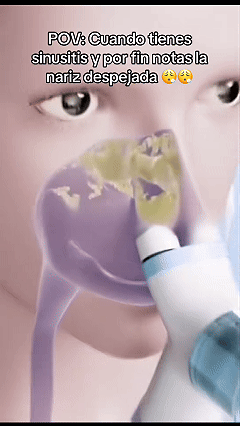 Nasal Irrigation System, Electric Sinus Rinse Machine with 30 Salt Packets, Dual Water Tank Self-Cleaning and Automatic Waste Collection, Nasal Washer for Congestion & Sinus Care