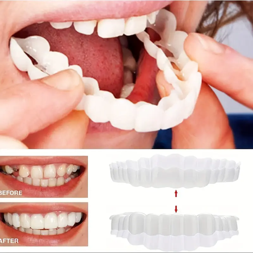 Buy one get two free Natural Denture Set | Food-Grade Resin | Comfort Fit for Men & Women