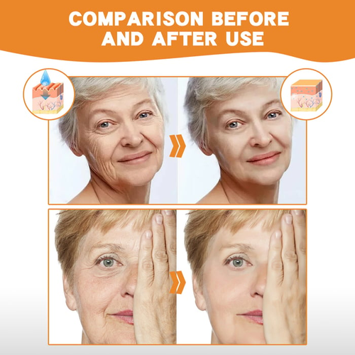 2026New Instant Skin Essence Collagen Set - 20 years younger after use