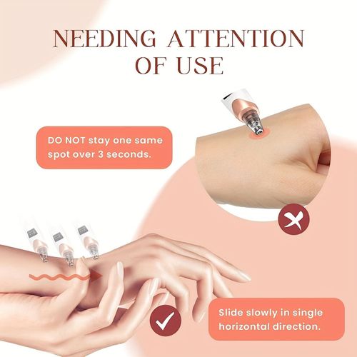 blackhead remover