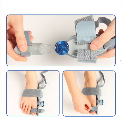 Bunion Relief Splint - Adjustable Toe Straightener with Control Knob for Hallux Valgus & Overlapping Toes, Fits Both Men & Women