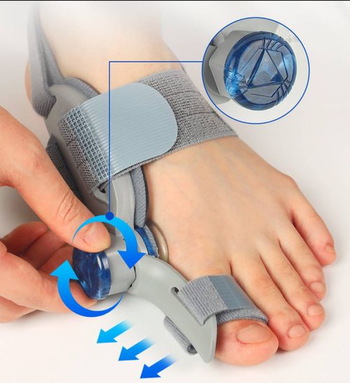 Bunion Relief Splint - Adjustable Toe Straightener with Control Knob for Hallux Valgus & Overlapping Toes, Fits Both Men & Women