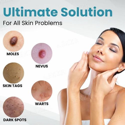 ⚡️BEST DEAL TODAY🔥Non-Invasive Mole and Wart Removal Laser Pen