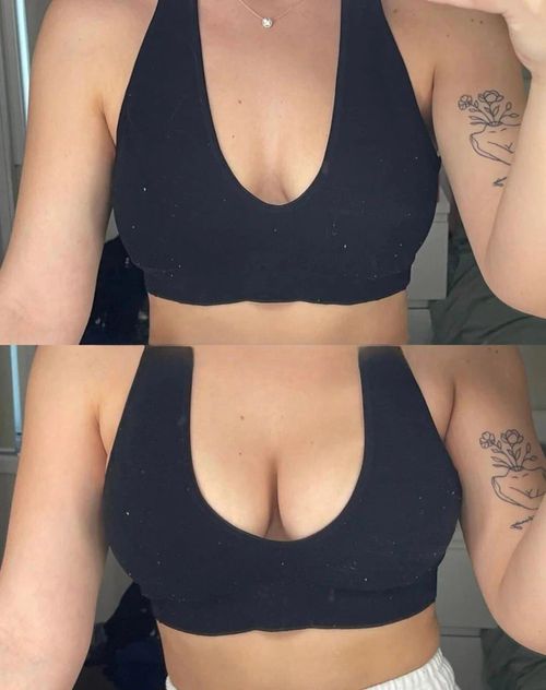 💥Last Day Promotion 49% OFF💥Self-Adhesive Bra Inserts